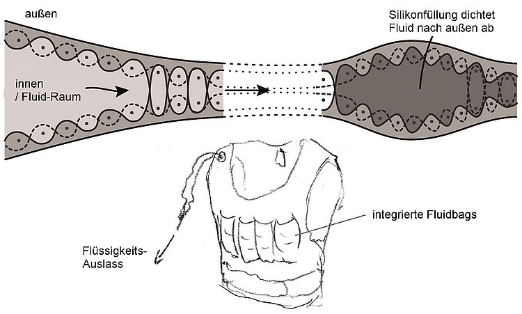 Schema der Abdichtungsstrategie (oben) und Skizze eines Anwendungsbeispiels Weste/Bandage mit integrierten Fluidbags und Auslass (unten).